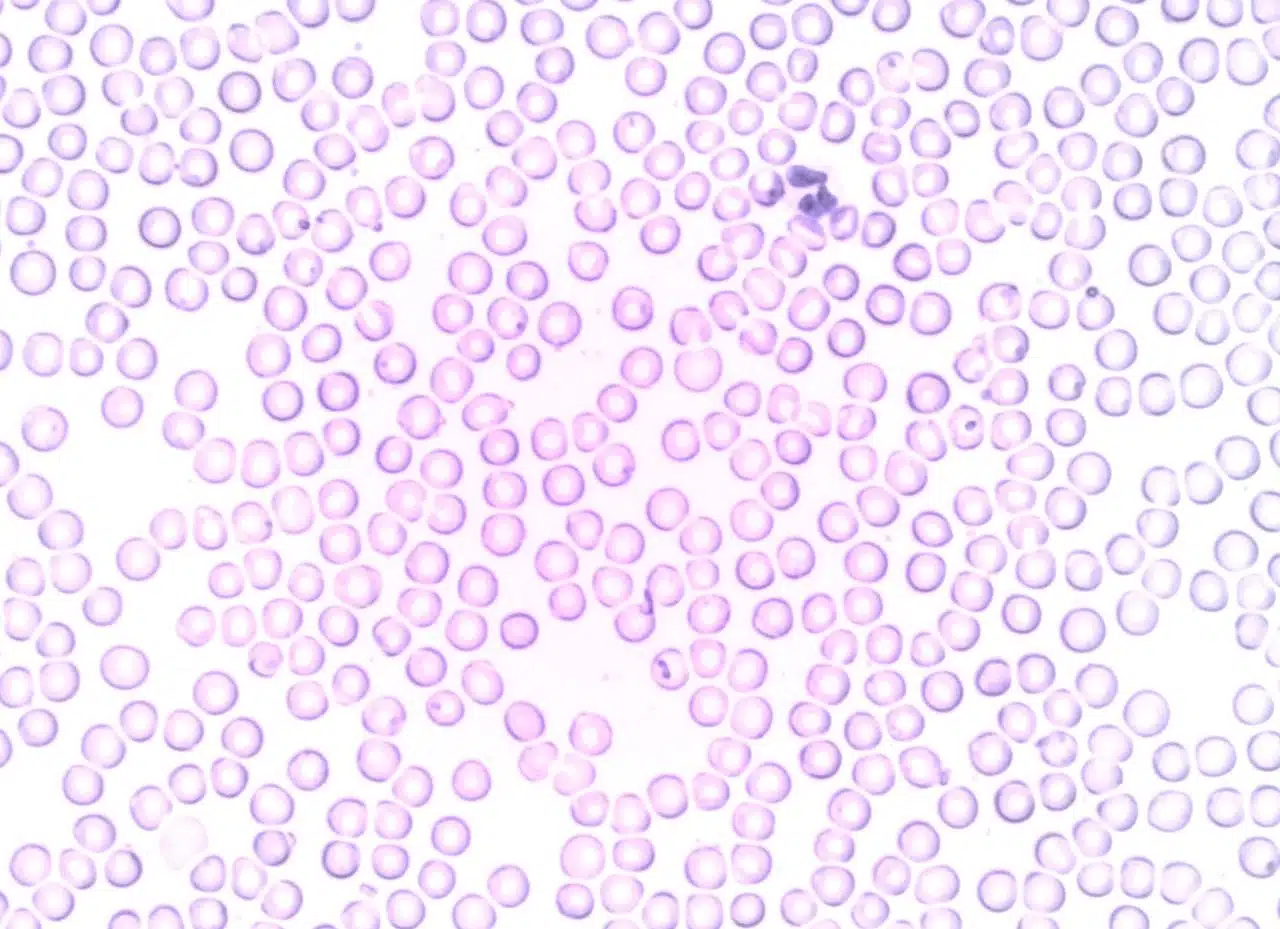 Leukocytes