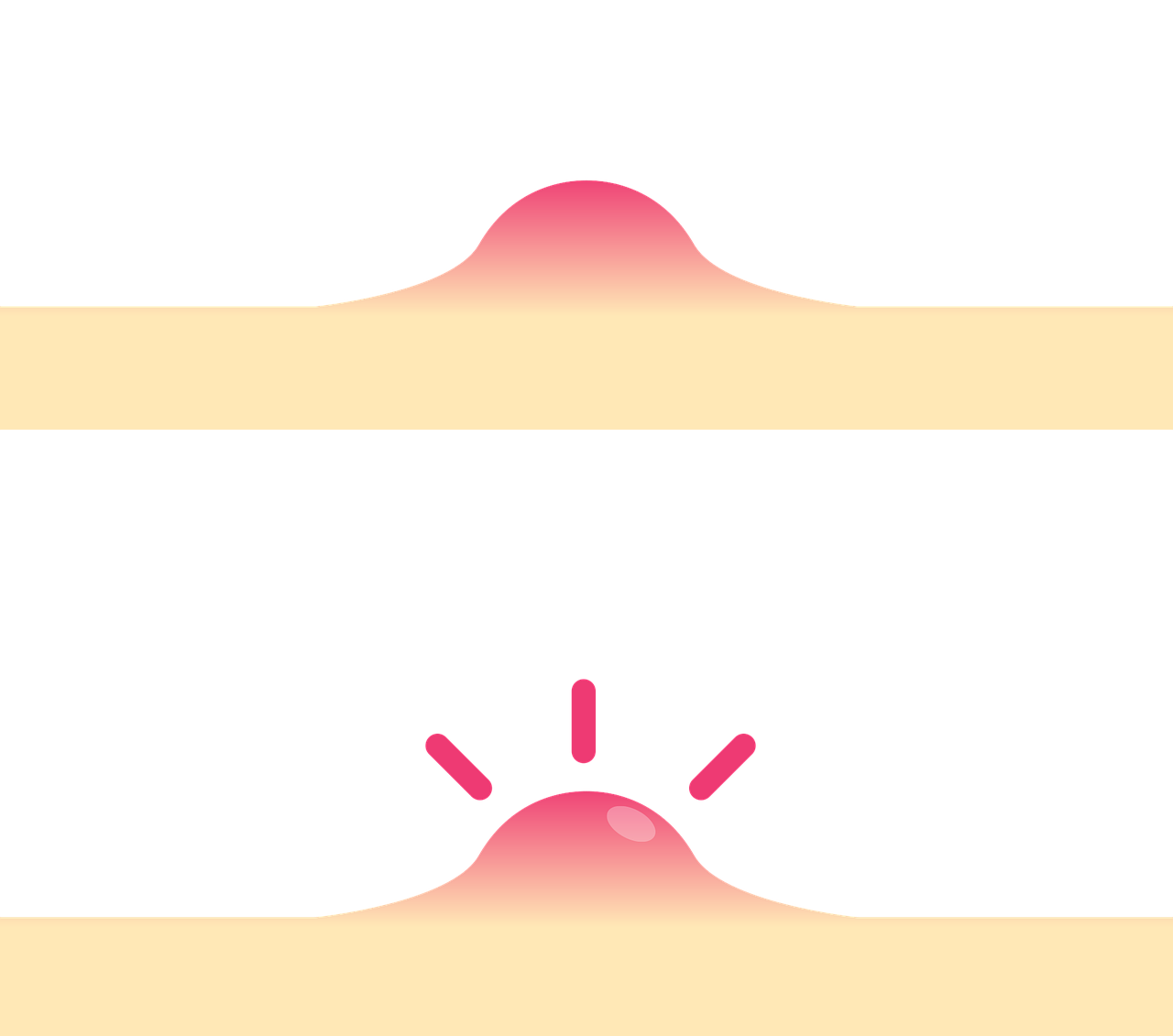 skin swelling