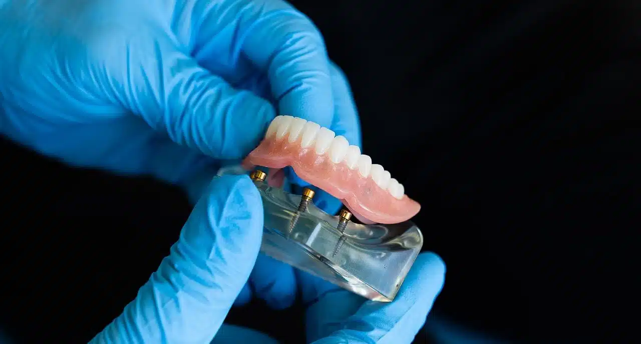 Dental prosthesis