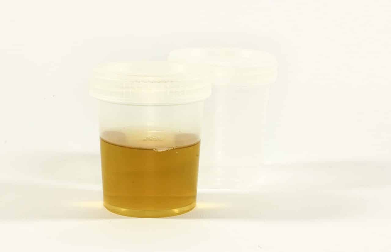 Urine