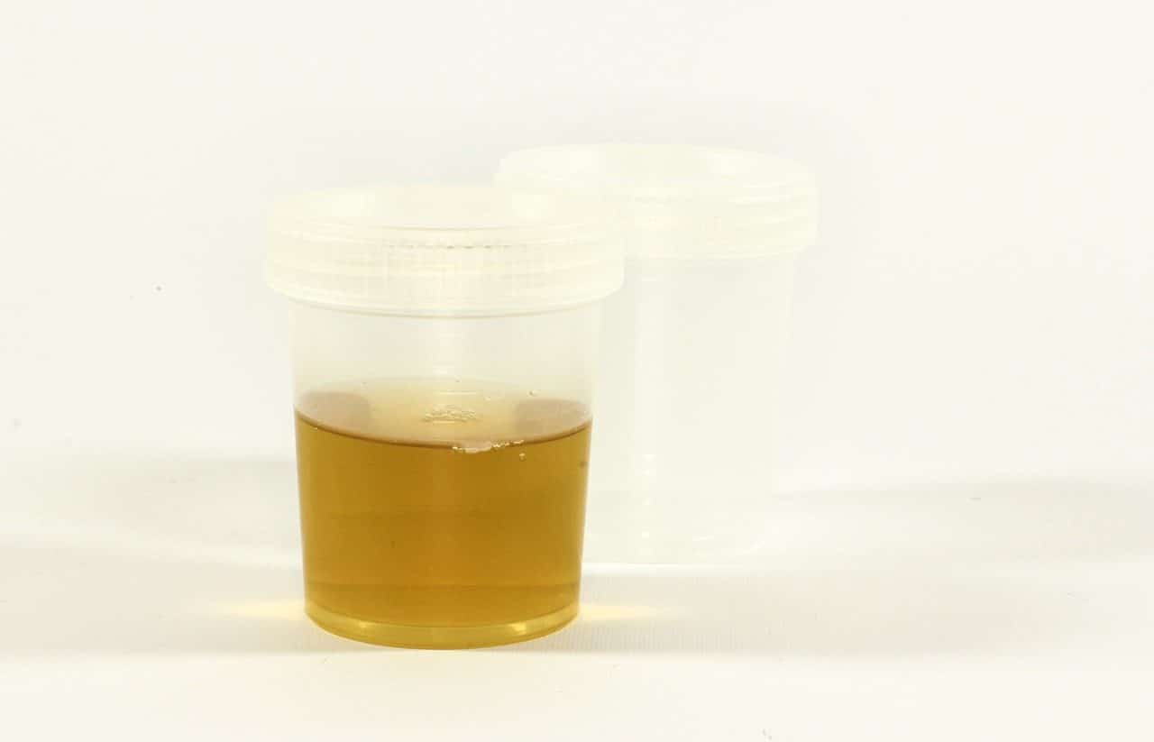 Urine