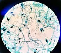 Cyanobacteria