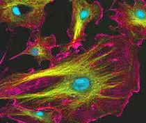 Cytoskeleton