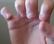 Cuticle