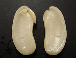 Embryo