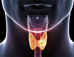 Hyperthyroidism