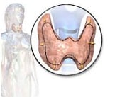 Hyperthyroidism