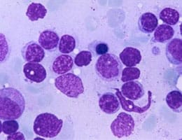 Lymphocytes