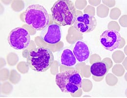 monocyte