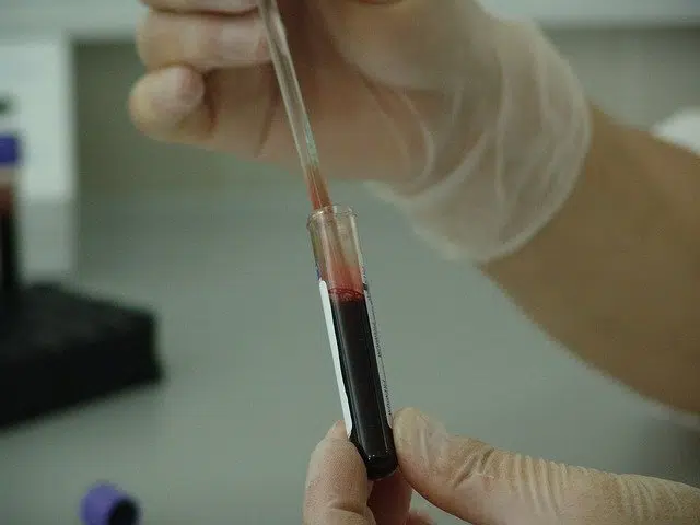 Neutrophil blood test