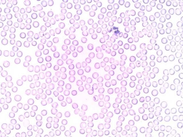 segmented neutrophil