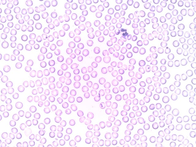 leukocyte macrophage