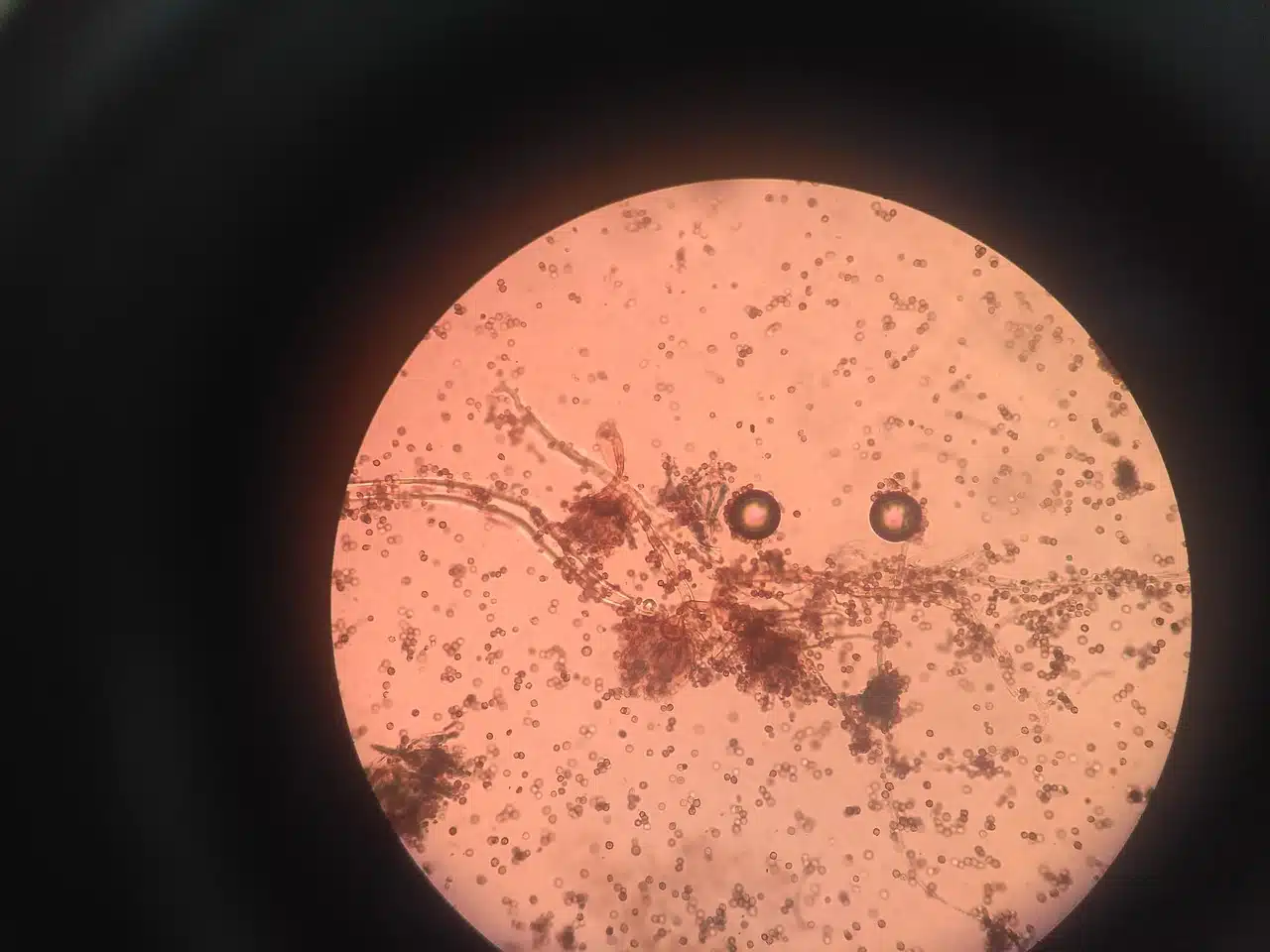 Microscopic view of parasites