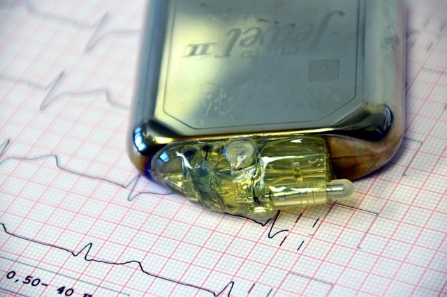 Electrophysiology Pacemaker